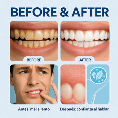 Aqualis HydroDental™  + Ebook de Regalo